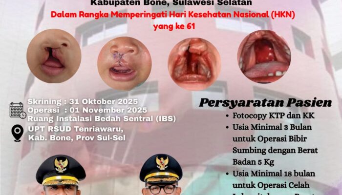 Gratis! RSUD Tenriawaru Bone Bakal Gelar Operasi Gratis Celah Bibir dan Lelangit